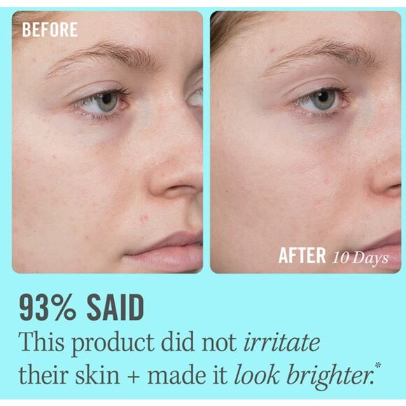 First Aid Beauty 10% Vitamin C Brightening Serum - 1.7 fl oz/50 ml - NIB - Picture 6 of 7